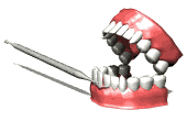 Illustration of a dental hygienist tool to remove plaque and scale from the surfaces of the teeth